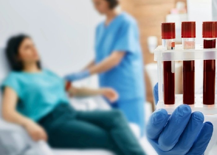 Blood test