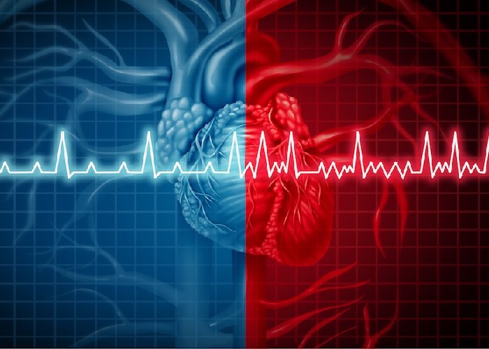 ECG